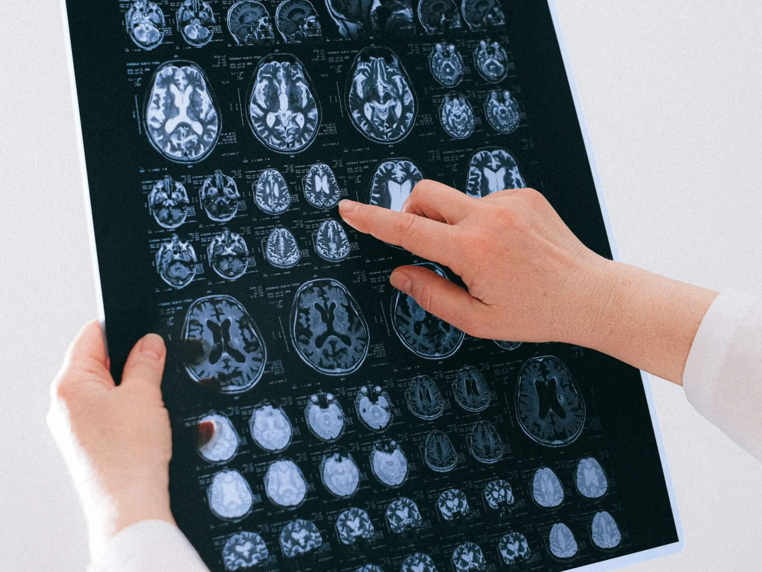  Doctor holding up images of brain scans 